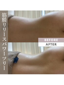 リノリー 古川店(rinory)/筋膜リリース＜パワーツリー＞