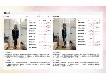 エスリハ整骨院 整体院/AI姿勢診断(サービス)