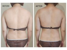 ラプタス(Rapu+)の雰囲気(肩と背中のもっこり肉を撃退!一回り小さい後姿に)