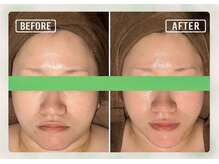 サロン ド メタセコイア(salon de Metasequoia)/リフトアップ／before☆after