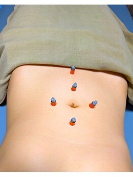 パウズ(Paws)の写真/鍼灸施術◎妊活による冷え改善・ホルモンバランス改善