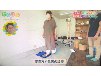 オーサポート(O-support)/