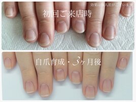 最強のネイルケア(自爪育成)赤羽