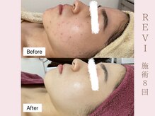 ルア(LuA.)/圧倒的美白！透明感！