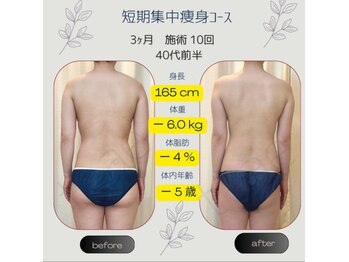 ティアエ(T-ae)/本気ヤセ【短期集中痩身コース】