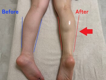 ココリラ/睡眠｜ヘッドマッサージ｜リンパ