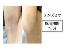 メンズビオ 神戸三宮店/