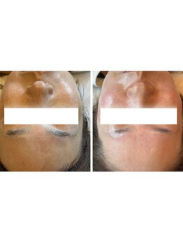 ミイル(Miiru)/◇内観◇