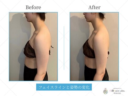 小顔フェイスラボ 新潟店(小顔FaceLabo.)の写真