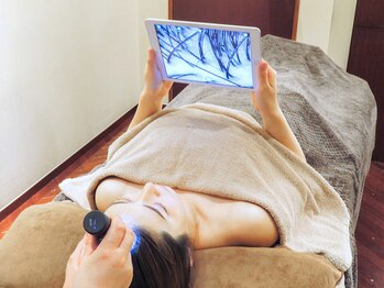 銀座グレース/マイクロスコープで頭皮チェック