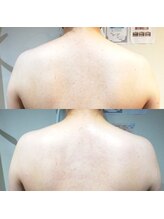 RiとBiのたまご/1回のビフォーアフター