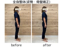 ヴィーネス(VIENESS)の雰囲気（【全身美容整体＋骨盤矯正】姿勢改善したい方にオススメ◎）