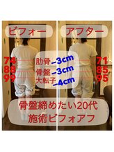 ヒカリノキュウジツ(Hikarino休日)/骨盤調整