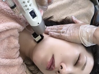 フォーエアリー(4+airuy)の写真/【医師監修！最高水準の肌管理で美肌をご体感】圧倒的な変化で痛みやダウンタイムがほとんどない"Exolift"
