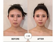 小顔コルギ 90分 1回施術　一度でわかりやすい変化◎