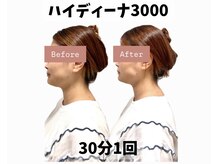 ヨサパーク ポノン(YOSA PARK ponon)/【Before→After】