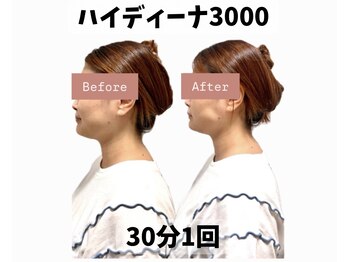 ヨサパーク ポノン(YOSA PARK ponon)/【Before→After】