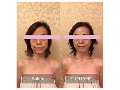 リンパケア顔筋美容のフフ(ff)の写真