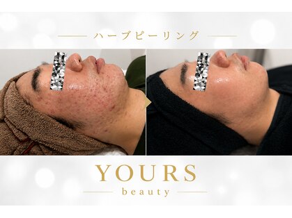 ユアーズ ビューティー(YOURS beauty)の写真
