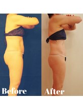 トータルビューティサロン クイーン(Queen)/横の厚みもスッキリ！