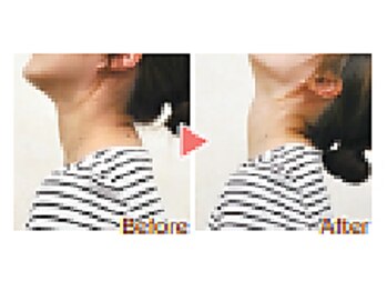 くすの木 治療院/上向いてるつもりかも。。。