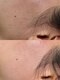ジュリア(JULIA)の写真/【美肌フェイスワックスで思わず触りたくなるお肌に★】化粧ノリやお顔全体のトーンUPにも◎速効垢抜け♪
