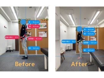 ナオル整体 大阪茨木院(NAORU整体)/大阪茨木/ 整体・矯正