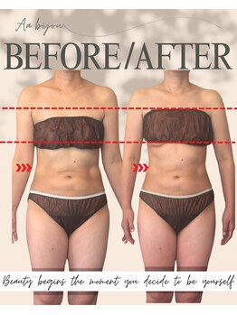 エイエービジュー(Aa.bijou)/