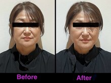 トゥジュール(Toujours)/骨格矯正美顔コース(さつま式)