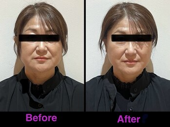 トゥジュール(Toujours)/骨格矯正美顔コース(さつま式)