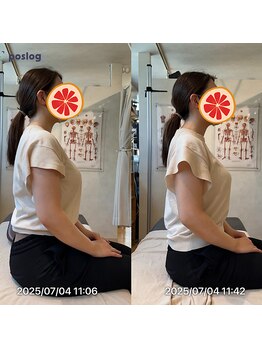 グレフル鍼灸接骨院 整体院 心斎橋/整体/肩こり/マッサージ/腰痛