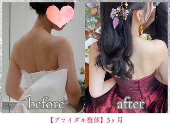 ボディメイク アールエフ サクラ接骨院(bodymake RF SAKURA接骨院)/ブライダルエステ（整体）3ヶ月