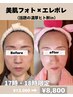 17.18時限定 隙間時間に肌改善美肌フォト×エレポレ+ヒト幹¥13,000→¥9800