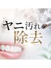 【愛煙家の方に】ヤニ汚れ除去+32分照射ホワイトニング ¥10,460→¥8,470