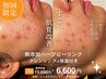 【１日1名限定】NEW！効果がすごい！ハーブピーリング(75分)カウンセリング込
