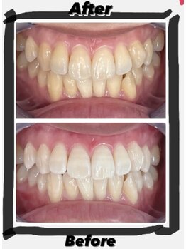 ホワイトニングビューティー 名古屋栄店(WHITENING BEAUTY)/セルフホワイトニング