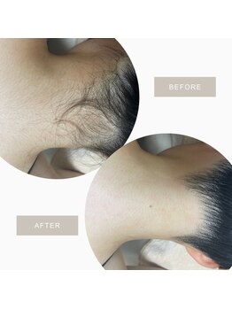 オフオルファヴォリ(OF Olu:Favori)/【フラッシュワックス脱毛】