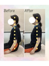 浜町アネックスあさひ整体院/【ビフォーアフター】