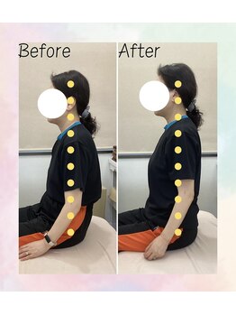 浜町アネックスあさひ整体院/【ビフォーアフター】