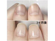 ラウレアルーム(Laule'a room)の雰囲気（【美爪育成ジェル】3ヶ月で変わる♪広がる爪も縦長に育成します!）