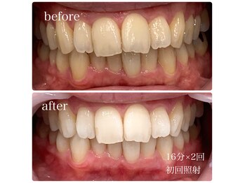 ホワイトニングカフェ 仙台八幡店