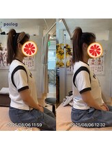 グレフル鍼灸接骨院 整体院 心斎橋/整体/肩こり/マッサージ/腰痛