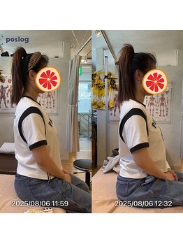 グレフル鍼灸接骨院 整体院 心斎橋/整体/肩こり/マッサージ/腰痛