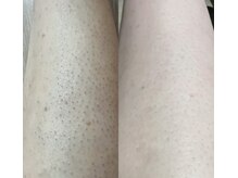 ホットワックス1回の効果。