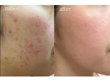 トラブルには必ず原因があります。まずは原因を知ることから。