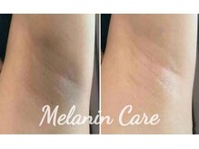 ペキュリア 恵比寿店(PEQLIA)/最新の黒ずみケアで脇ケア♪