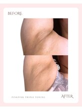 ビジュアルラボ(VISUAL LABO)/