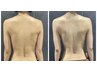 先着15名様限定！【肩甲骨はがし/美脚コルギ】背面集中！ボディコルギ★ 60分