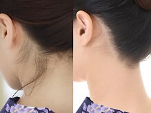 ビースキン 広島(BE:SKIN)
