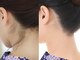 ビースキン 広島(BE:SKIN)の写真
